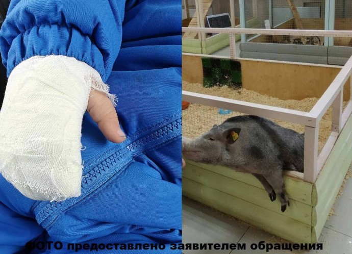 В томском контактном зоопарке девочку покусала свинья