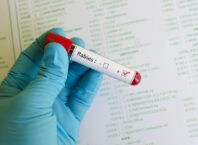 Как защитить питомца и себя от бешенства